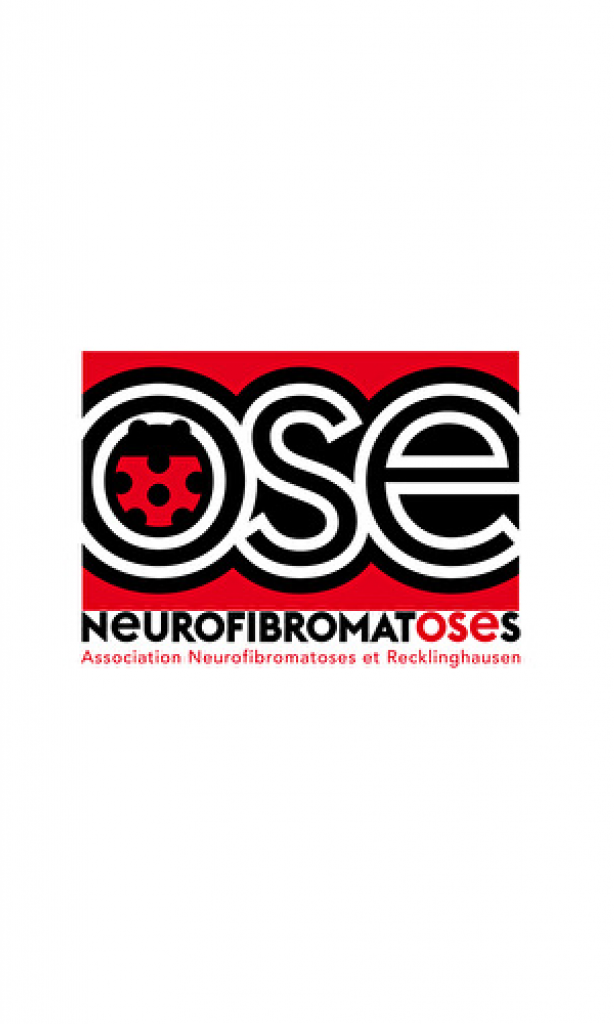 OSE – association neurofibromatoses